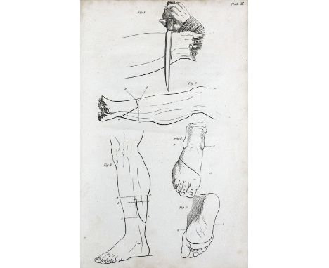 GUTHRIE, G.J. On gun-shot wounds of the extremities, requiring different operations of amputation, with their after treatment