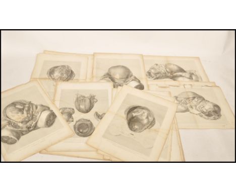 William Hunter - The Anatomy Of The Human Gravid Uterus ( 1851 ) - A collection / series&nbsp;of 23x large lithograph anatomi