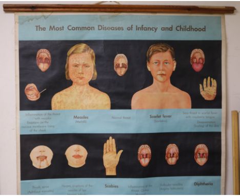 Four vintage medical educational posters