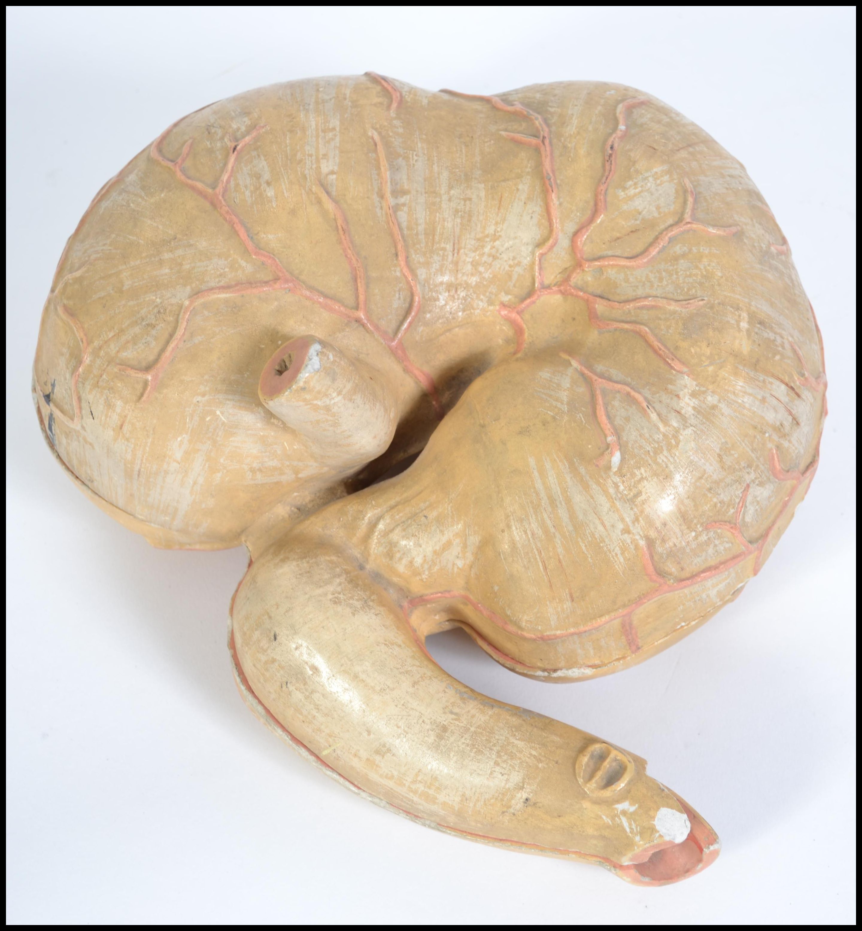 A 20th century medical model of a human stomach split onto two halves